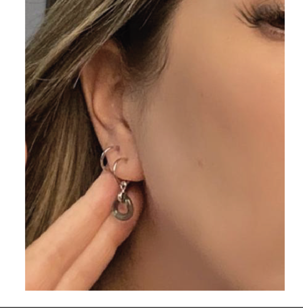 Asymmetric Arracaditas